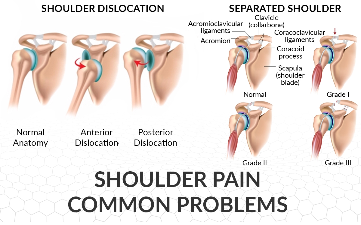 Shoulder Pain Common Problems - Dr. Saurabh